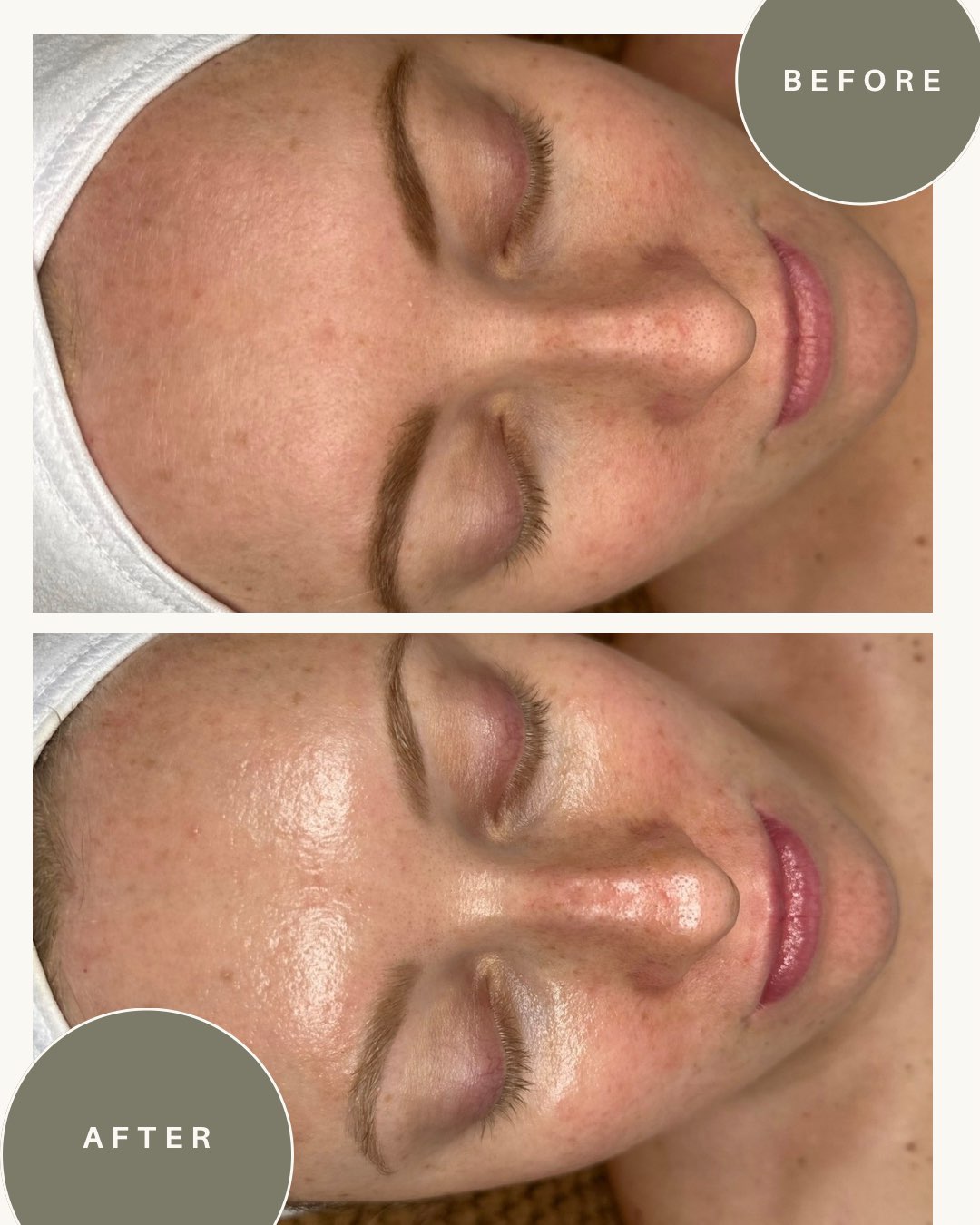 Before and after treatment